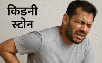 कमर के दाईं ओर तेज़ दर्द से कराहता हुआ व्यक्ति – किडनी स्टोन का संकेत